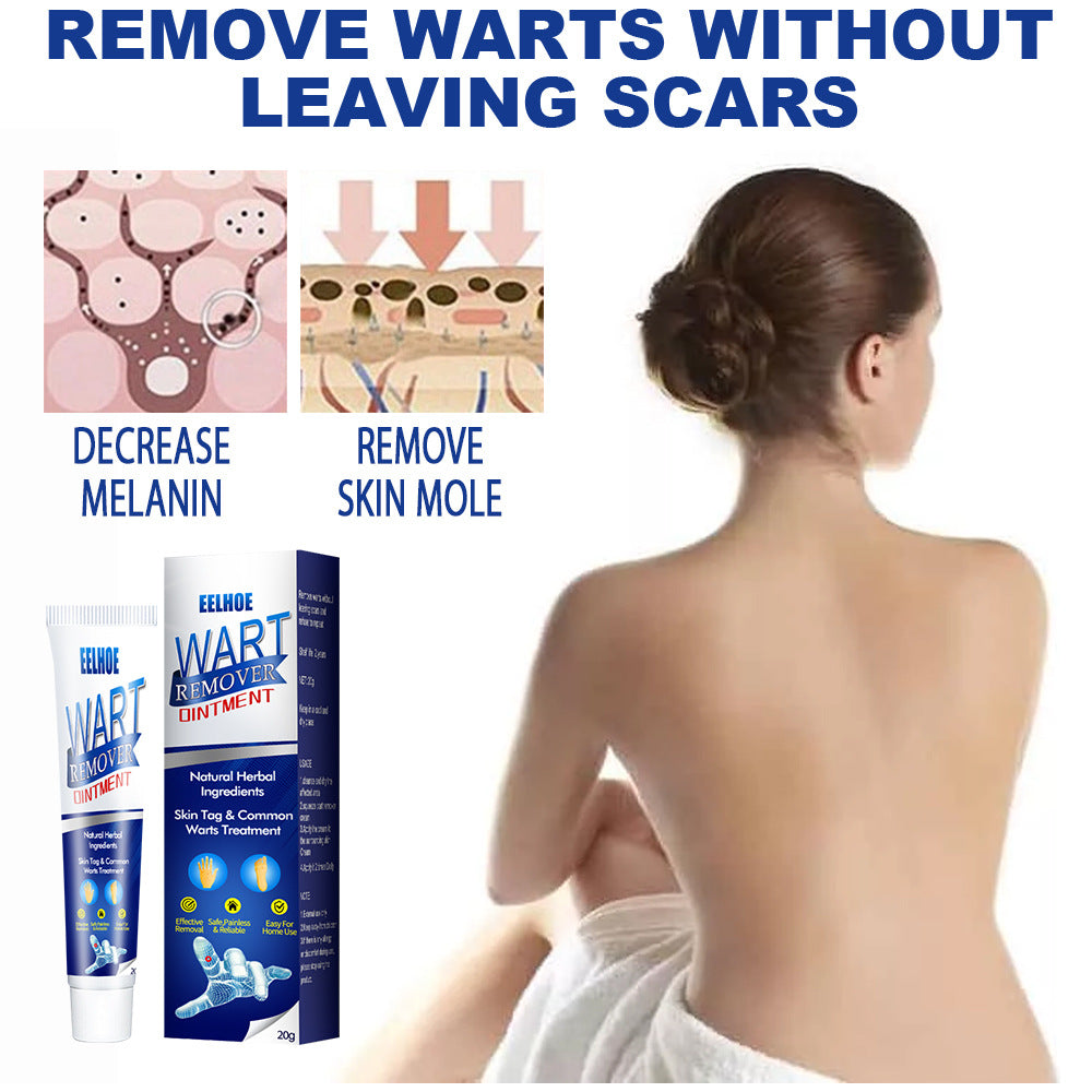 Zhongcao Keyou Liquid Skin Warts Ordinary Yukeyou Ointment Wart Removing Cream